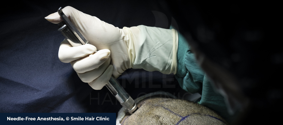 Needle-Free Anesthesia in FUE Hair Transplantation Turkey Prices 2023 -  Smile Hair Clinic
