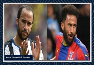 Andros Townsend Hair transplant before and after