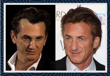 Celebrities Hair Transplants - Smile Hair Clinic Celebrities Hair Transplants - Smile Hair Clinic