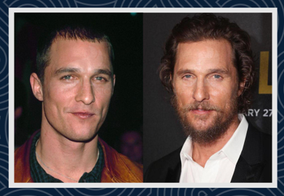 Celebrities Hair Transplants - Smile Hair Clinic Celebrities Hair Transplants - Smile Hair Clinic