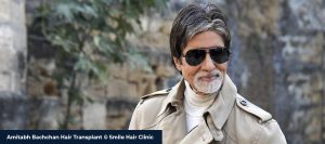 Amitabh Bachchan Hair Transplant - Smile Hair Clinic Amitabh Bachchan Hair Transplant - Smile Hair Clinic