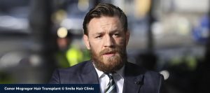 Conor Mcgregor with long hair after a hair transplant