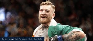 Conor Mcgregor with short hair after a hair transplant