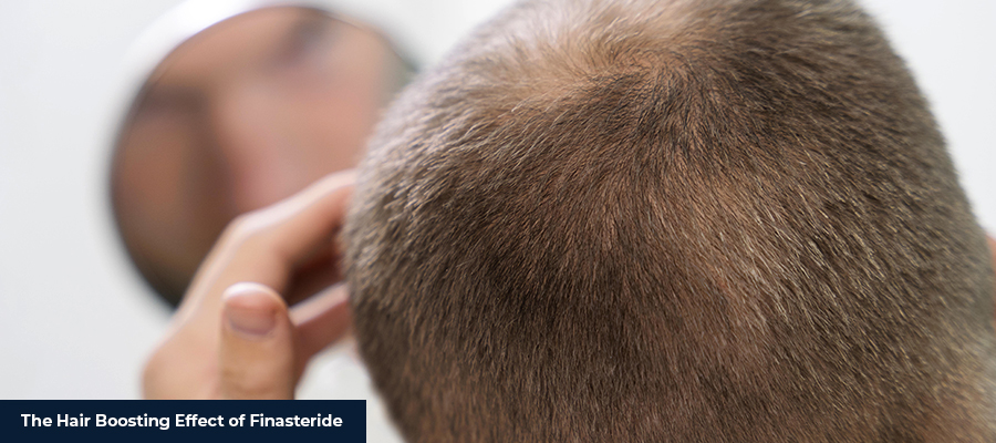 Hair Boosting Effect of Finasteride 