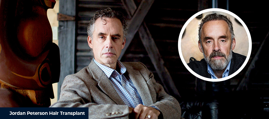 Jordan Peterson Before After