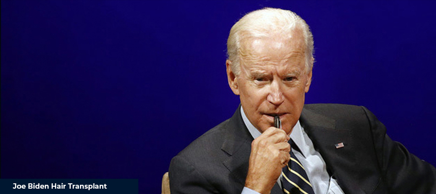 Joe Biden Hair Transplant