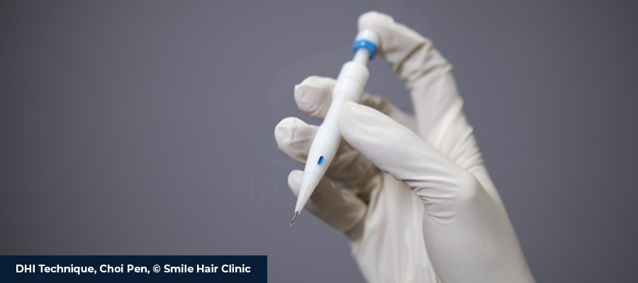 DHI Vs FUE 2 DHI Vs FUE