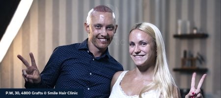 BEST HAIR TRANSPLANT 02