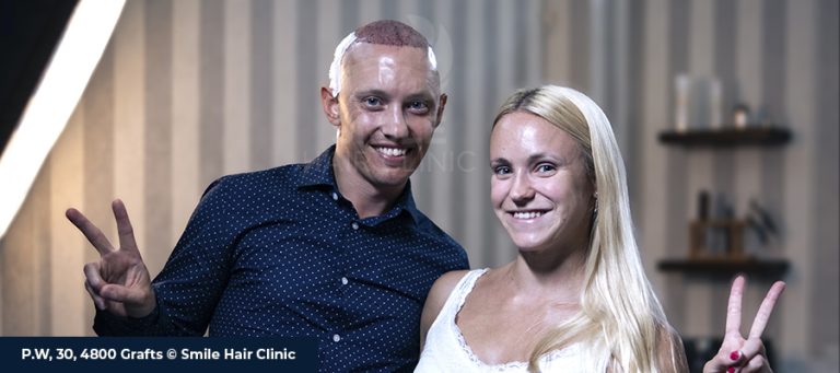 Best Hair Transplant