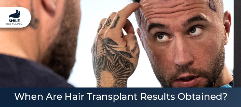 When Are Hair Transplant Results Obtained?