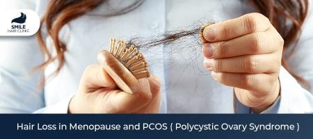 Hair-Loss-in-Menopause-and-PCOS-(-Polycystic-Ovary-Syndrome-)jpg