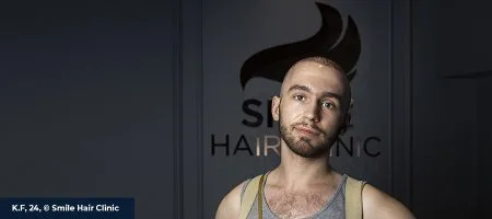 vucut-kili-sac-ekimi