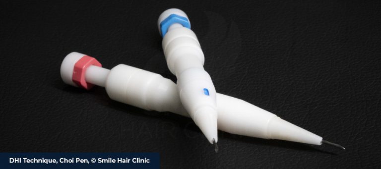 DHI-Haartransplantation