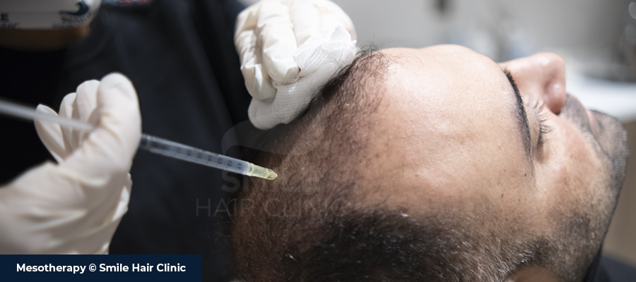 Haarbehandlung mit Mesotherapie