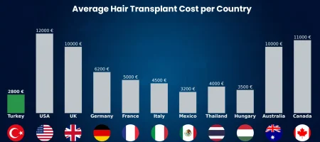 hair-transplant-turkey-cost
