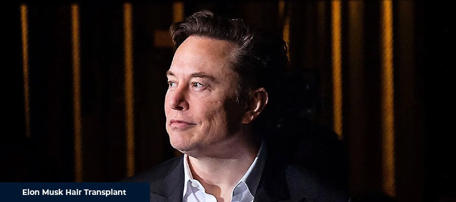 Elon Musk Hair Transplant