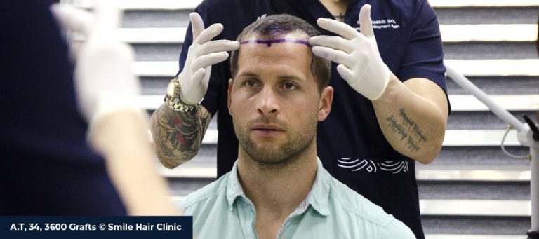 Buzëqeshje Filozofia e Vërtetë