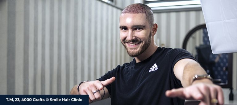 Best Hair Transplant in the World