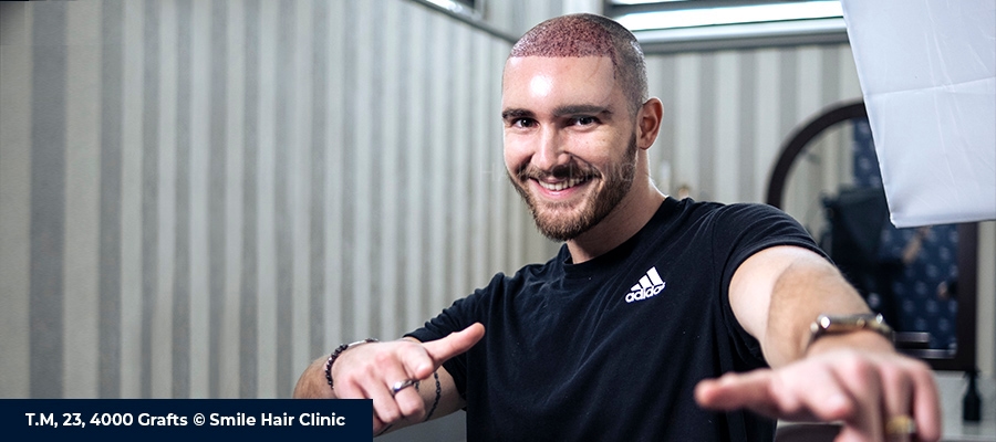 Best Hair Transplant in the World