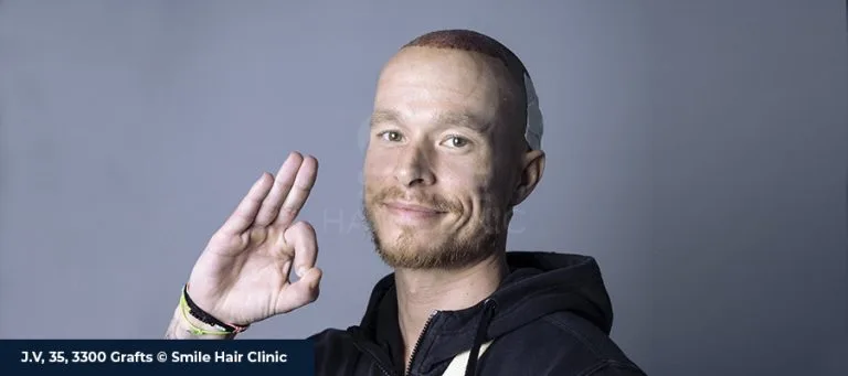 10 Criteria to Consider When Choosing a Hair Transplant Clinic