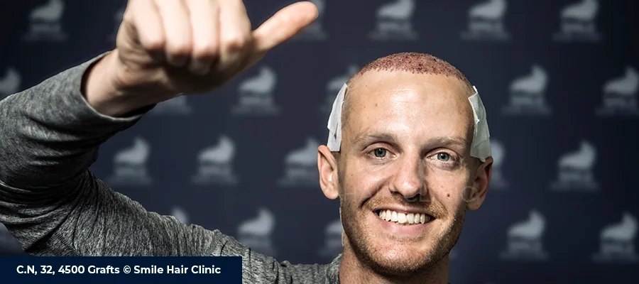 How Long Does a Hair Transplant Take? FUE, DHI & Sapphire FUE Duration Guide