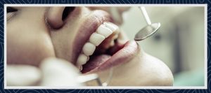 Tandimplantat 2 Tandimplantat