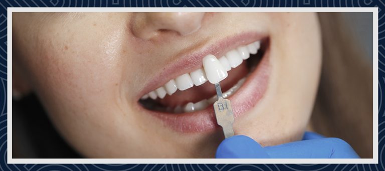 Dental Veneers Turkey