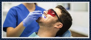 A photo during the teeth whitening operation