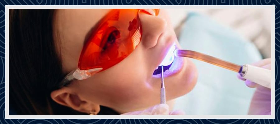 Professional Teeth Whitening 2 Professional Teeth Whitening