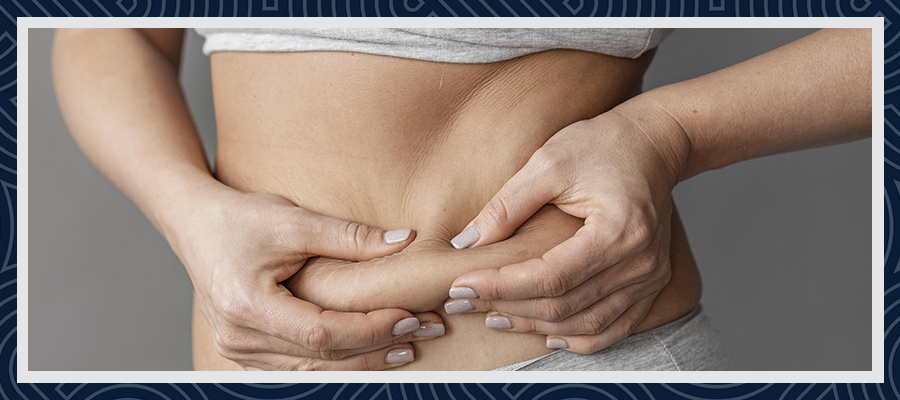 What is Liposuction Turkey?