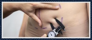 タミータックターキーとは何ですか?