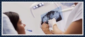 七面鳥の歯について 2 七面鳥の歯について