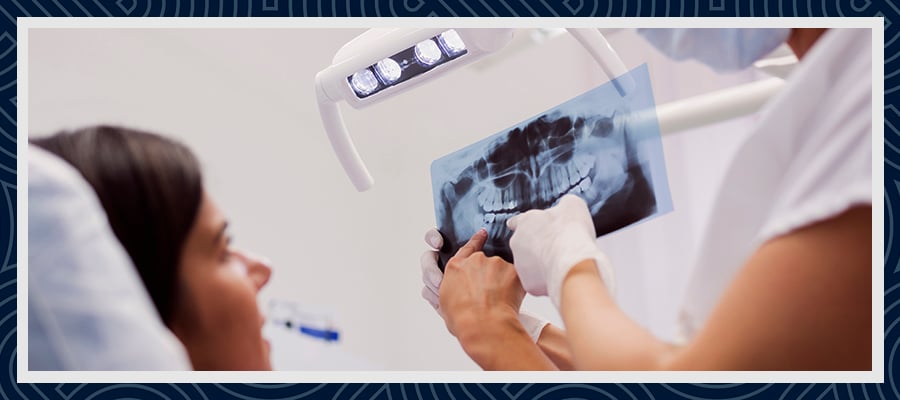 All About Turkey Teeth 2 All About Turkey Teeth