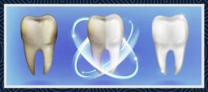 七面鳥の歯について 3 七面鳥の歯について