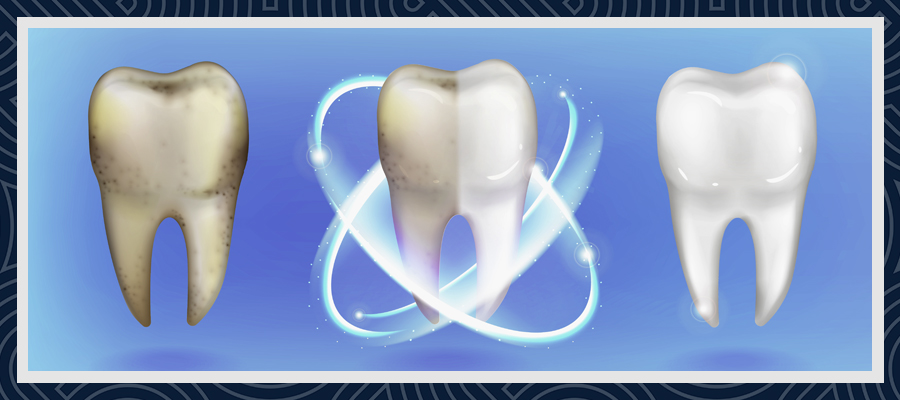 All About Turkey Teeth 3 All About Turkey Teeth