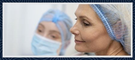 face lift before and after