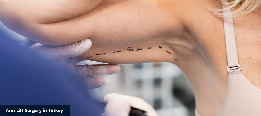 Arm Lift Surgery in Turkey 1 Arm Lift Surgery in Turkey