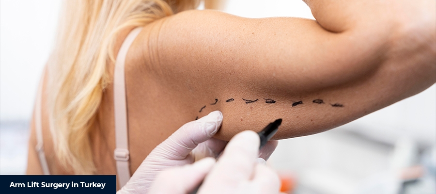 Arm Lift Surgery in Turkey