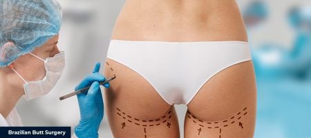 Brazilian Butt in Turkey