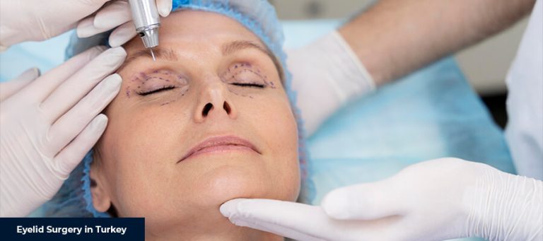 Eyelid Surgery in Turkey