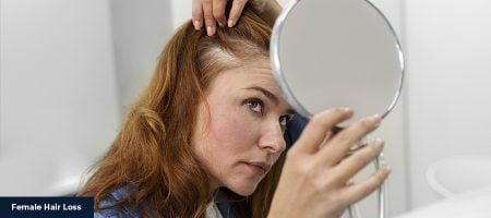 Female Hair Loss