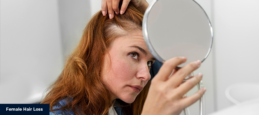 Female Hair Loss