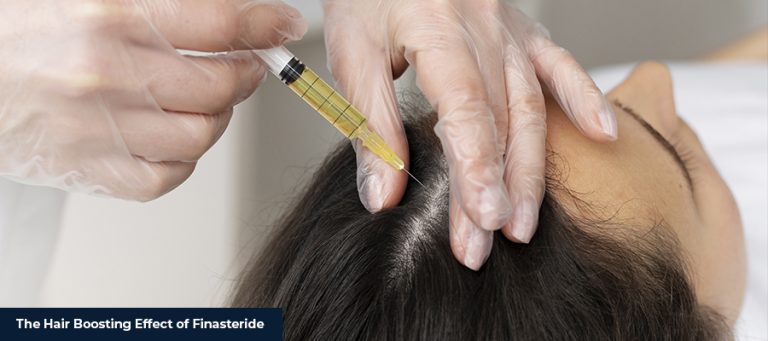 Hair Boosting Effect of Finasteride