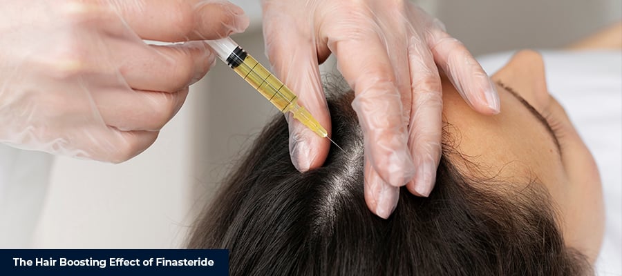 Hair Boosting Effect of Finasteride