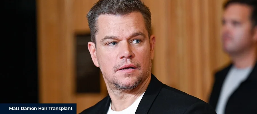 Matt Damon Hair Transplant 2 Matt Damon Hair Transplant