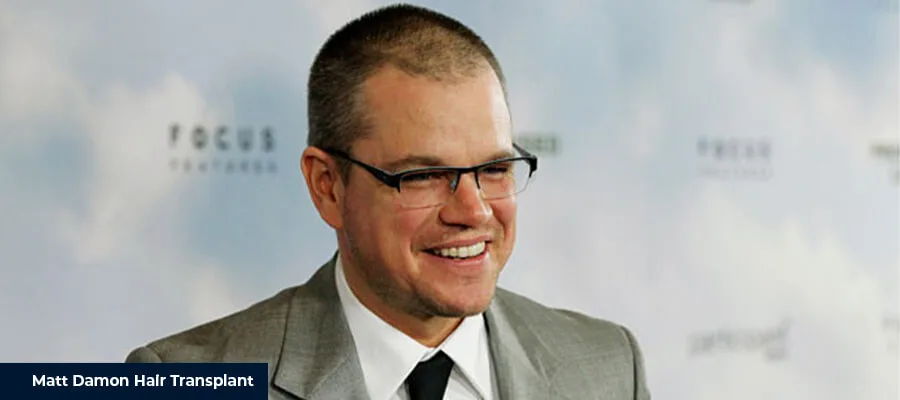 Matt Damon Hair Transplant 1 Matt Damon Hair Transplant