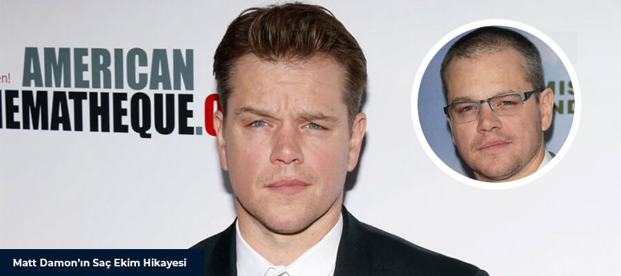 Yetenekli Oyuncu Matt Damon’ın Saç Ekimi