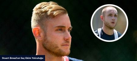 Stuart-Broad-Before-After