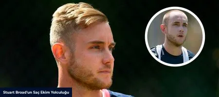 Stuart-Broad-Before-After