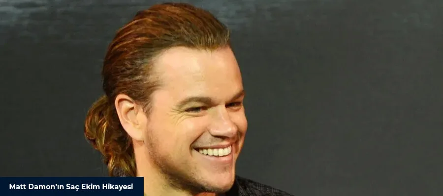 Yetenekli Oyuncu Matt Damon'ın Saç Ekimi
